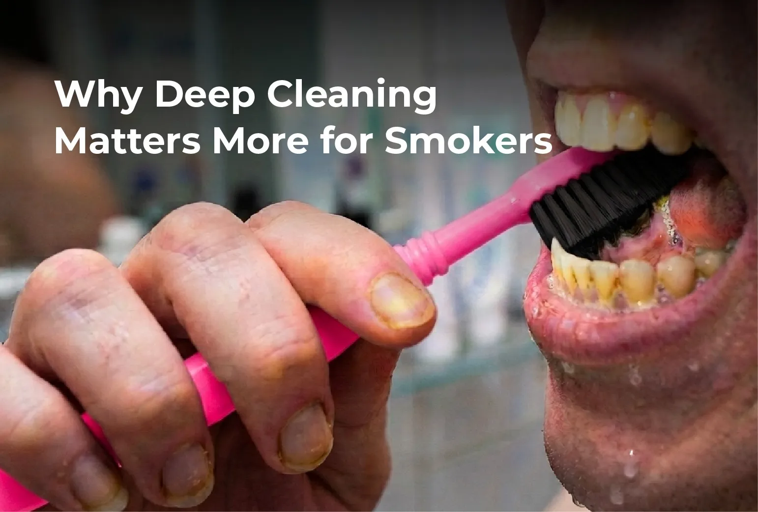 Why Deep Cleaning Matters More for Smokers